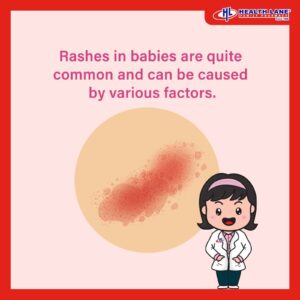 Rash in baby