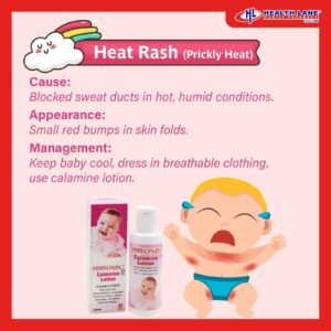 Rash in baby heat rash