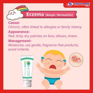 Rash in baby eczema