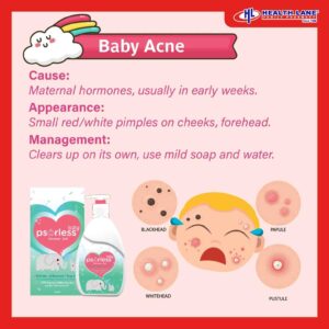 Rash in baby baby acne